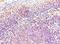CD20 antibody, MBS969007, MyBioSource, Immunohistochemistry paraffin image 