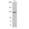 Protein SMG7 antibody, LS-C386102, Lifespan Biosciences, Western Blot image 