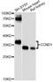 Cyclin D1 antibody, A1301, ABclonal Technology, Western Blot image 