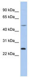 Chymotrypsinogen B1 antibody, TA334293, Origene, Western Blot image 