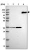 Complement component C6 antibody, NBP1-91803, Novus Biologicals, Western Blot image 