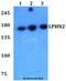 Adhesion G Protein-Coupled Receptor L2 antibody, LS-C411928, Lifespan Biosciences, Western Blot image 