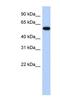 Zinc Finger Protein 554 antibody, NBP1-80401, Novus Biologicals, Western Blot image 