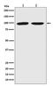 DNA Methyltransferase 3 Beta antibody, M00319, Boster Biological Technology, Western Blot image 