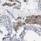 Mov10 Like RISC Complex RNA Helicase 1 antibody, PA5-53898, Invitrogen Antibodies, Immunohistochemistry paraffin image 