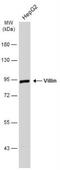 Villin 1 antibody, NBP1-32841, Novus Biologicals, Western Blot image 