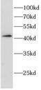 MAGE Family Member B18 antibody, FNab10765, FineTest, Western Blot image 
