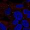 LDL Receptor Related Protein 1B antibody, NBP2-76566, Novus Biologicals, Immunocytochemistry image 