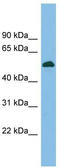 CUGBP Elav-Like Family Member 5 antibody, TA343907, Origene, Western Blot image 