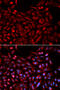 Nuclear Receptor Subfamily 1 Group I Member 3 antibody, 18-419, ProSci, Immunofluorescence image 