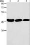 N(4)-(beta-N-acetylglucosaminyl)-L-asparaginase antibody, LS-C404464, Lifespan Biosciences, Western Blot image 