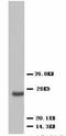 Vascular Endothelial Growth Factor D antibody, LS-C172150, Lifespan Biosciences, Western Blot image 