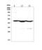 KRT18 antibody, M01357-4, Boster Biological Technology, Western Blot image 
