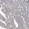 Actin-like 7B antibody, PA5-55147, Invitrogen Antibodies, Immunohistochemistry frozen image 