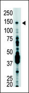 Ubiquitin Specific Peptidase 7 antibody, MBS9205900, MyBioSource, Western Blot image 