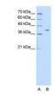 Pregnancy Specific Beta-1-Glycoprotein 6 antibody, NBP1-56485, Novus Biologicals, Western Blot image 