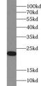 Acyl-CoA Thioesterase 6 antibody, FNab00092, FineTest, Western Blot image 