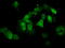 Protein Phosphatase Methylesterase 1 antibody, TA500821, Origene, Immunofluorescence image 