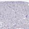 fTnT antibody, HPA037810, Atlas Antibodies, Immunohistochemistry frozen image 
