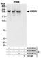 Ribosome Binding Protein 1 antibody, A303-995A, Bethyl Labs, Immunoprecipitation image 