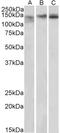 Stromal Antigen 2 antibody, LS-C112901, Lifespan Biosciences, Western Blot image 