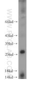 Chromatin Target Of PRMT1 antibody, 21456-1-AP, Proteintech Group, Western Blot image 