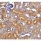DNA fragmentation factor subunit beta antibody, LS-C282, Lifespan Biosciences, Immunohistochemistry paraffin image 