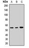 Lymphocyte Specific Protein 1 antibody, LS-C667891, Lifespan Biosciences, Western Blot image 