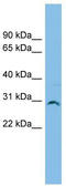 SNF8 Subunit Of ESCRT-II antibody, TA344525, Origene, Western Blot image 