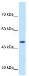 Signal Peptide Peptidase Like 2B antibody, TA335943, Origene, Western Blot image 