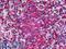 Lymphocyte Cytosolic Protein 1 antibody, LS-B5367, Lifespan Biosciences, Immunohistochemistry frozen image 