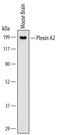 Plexin A2 antibody, MA5-24263, Invitrogen Antibodies, Western Blot image 