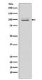 Kinesin-like protein KIF23 antibody, M03483, Boster Biological Technology, Western Blot image 