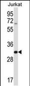 Phospholipase A And Acyltransferase 5 antibody, PA5-48645, Invitrogen Antibodies, Western Blot image 