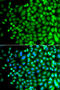 SPT20 Homolog, SAGA Complex Component antibody, 22-898, ProSci, Immunofluorescence image 