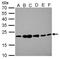 Receptor activity-modifying protein 2 antibody, PA5-21953, Invitrogen Antibodies, Western Blot image 