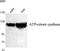 ATP Citrate Lyase antibody, A02372, Boster Biological Technology, Western Blot image 