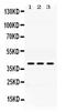 Alcohol Dehydrogenase 1A (Class I), Alpha Polypeptide antibody, PA5-78730, Invitrogen Antibodies, Western Blot image 
