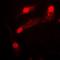 LIM Domain Kinase 2 antibody, orb214194, Biorbyt, Immunofluorescence image 