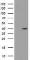 Deoxyhypusine Synthase antibody, GTX84616, GeneTex, Western Blot image 