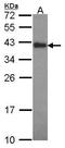 Cytokine Induced Apoptosis Inhibitor 1 antibody, TA308114, Origene, Western Blot image 