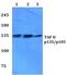 TATA-Box Binding Protein Associated Factor 4 antibody, PA5-36243, Invitrogen Antibodies, Western Blot image 