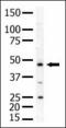 Phosphatidylinositol-5-Phosphate 4-Kinase Type 2 Alpha antibody, LS-C101116, Lifespan Biosciences, Western Blot image 