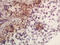 AT-Rich Interaction Domain 1B antibody, GTX60275, GeneTex, Immunohistochemistry paraffin image 