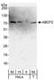 ATP Binding Cassette Subfamily F Member 2 antibody, A302-006A, Bethyl Labs, Western Blot image 