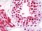 Ribosomal Protein L18 antibody, orb178923, Biorbyt, Immunohistochemistry paraffin image 