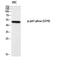 Neutrophil Cytosolic Factor 1 antibody, A01586S370, Boster Biological Technology, Western Blot image 