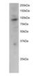 PML antibody, orb18326, Biorbyt, Western Blot image 