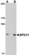 SPG11 Vesicle Trafficking Associated, Spatacsin antibody, LS-B3872, Lifespan Biosciences, Western Blot image 