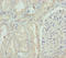 Glucosamine (N-Acetyl)-6-Sulfatase antibody, LS-C675822, Lifespan Biosciences, Immunohistochemistry paraffin image 